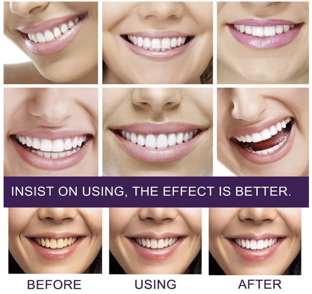 Smilekit Purple Whitening Toothpaste