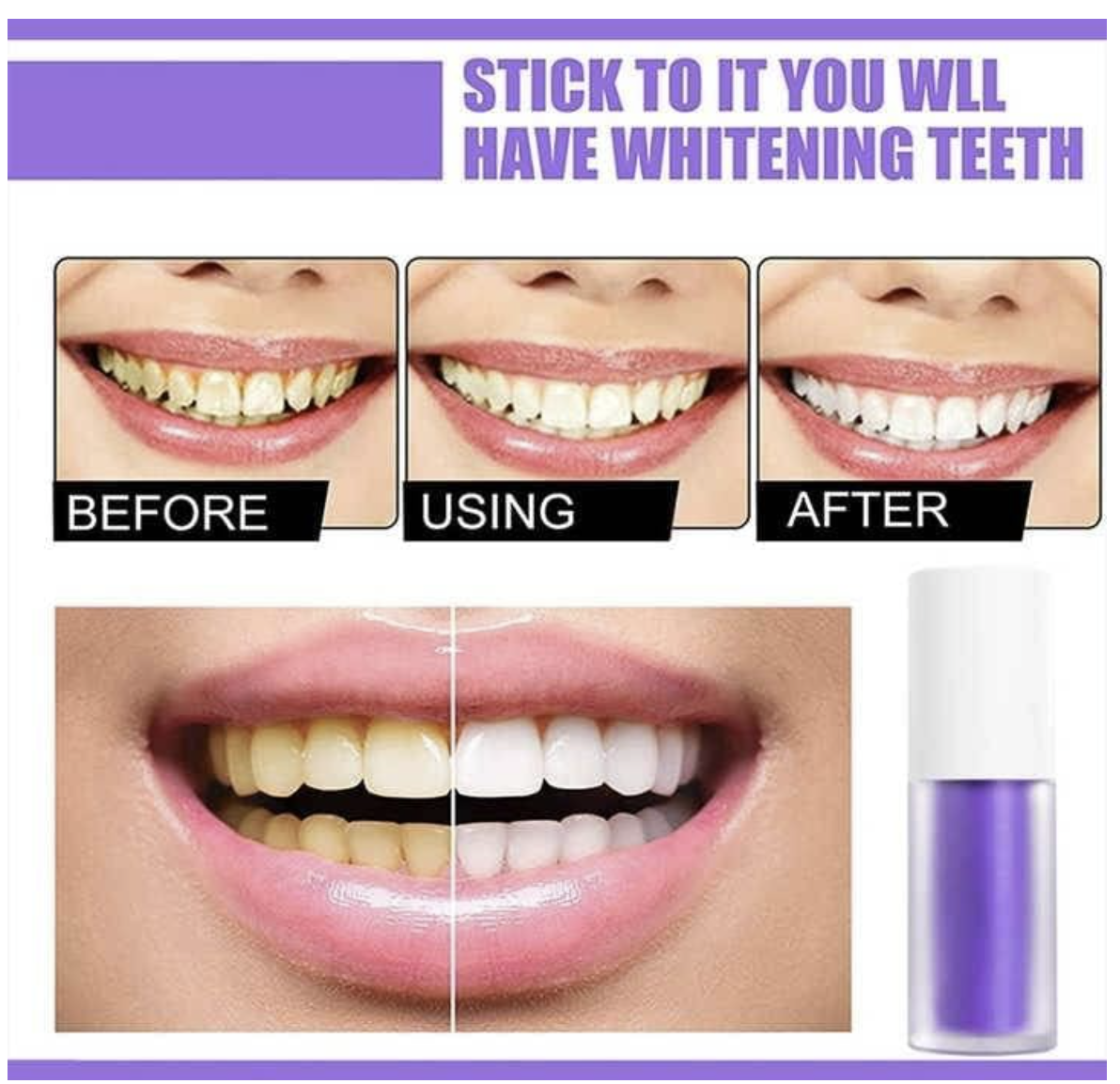 Smilekit Purple Whitening Toothpaste